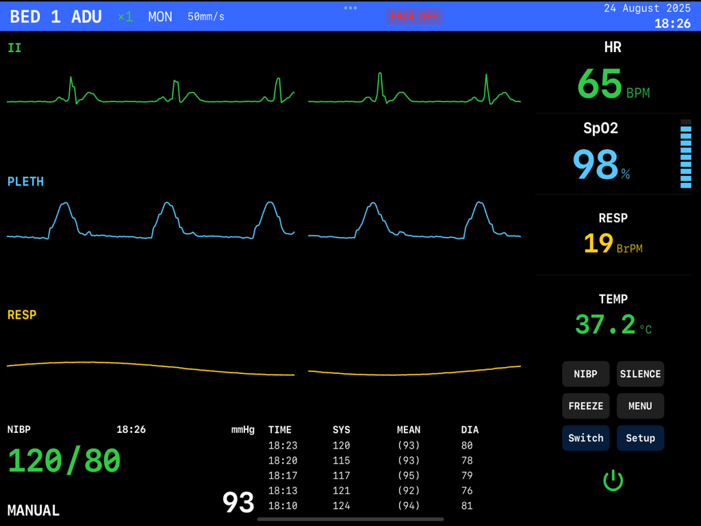 EKG Simulator - Interfaz de un simulador de monitor hospitalario que muestra formas de onda de EKG y signos vitales