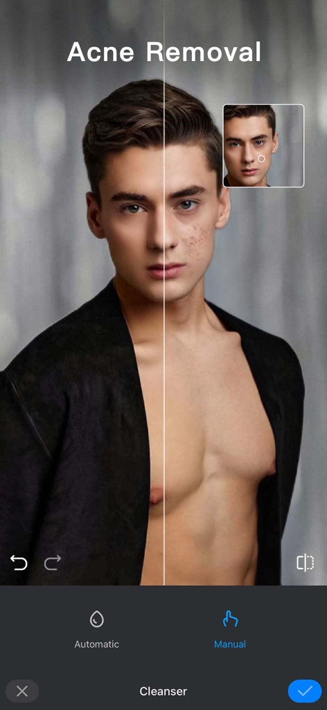 Comparación en pantalla dividida de la cara de un hombre antes y después de usar la herramienta de eliminación de acné