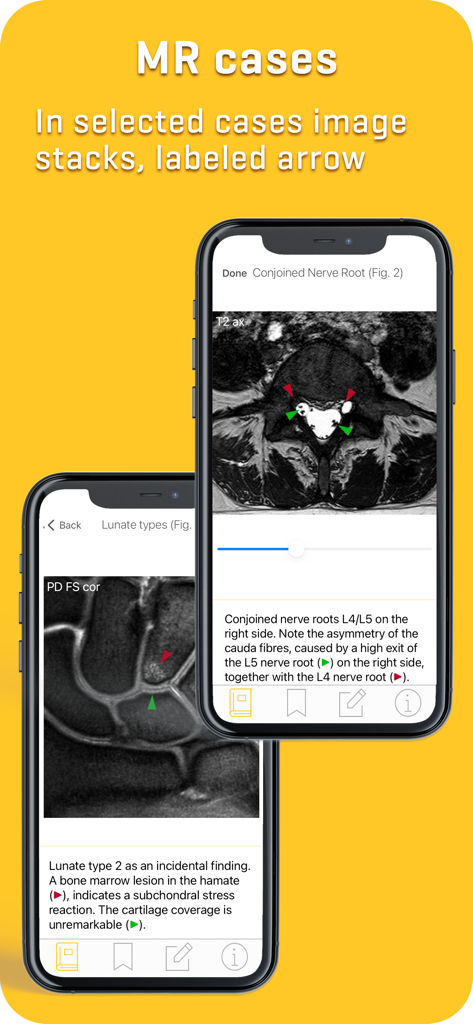 MRI-ESSENTIALS: MSK imaging - Health & Fitness App | MWM