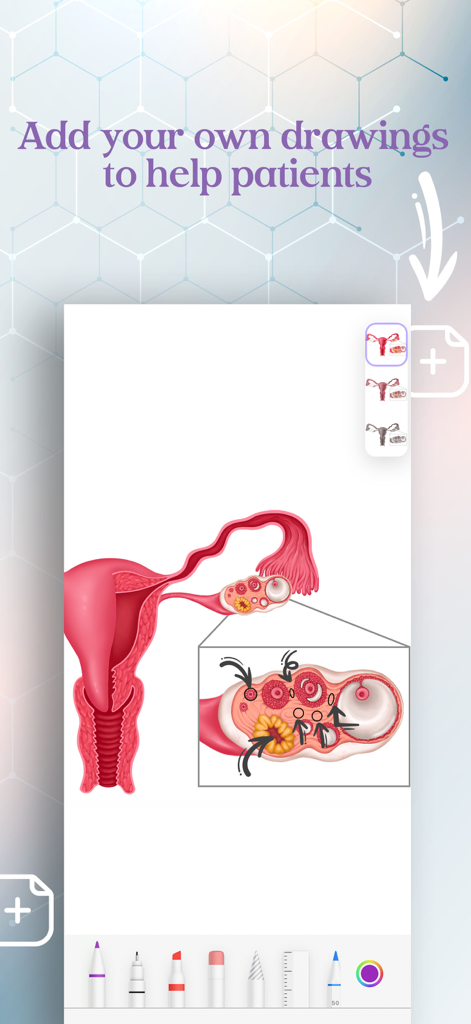 Clinic Visuals - Drawing tool interface on a female reproductive system diagram within the Clinic Visuals app for patient education